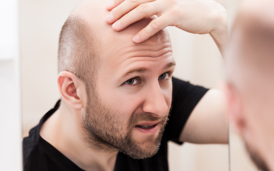 "Evidence-Based Insights: Unmasking the Genetics of Hair Loss and Tackling the 'Balding Gene'"